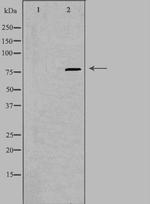 PIP5K1C Antibody in Western Blot (WB)