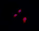 PKA C alpha/beta Antibody in Immunocytochemistry (ICC/IF)