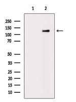 PLD1 Antibody in Western Blot (WB)