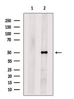 PLVAP Antibody in Western Blot (WB)