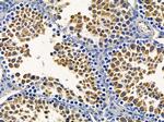 PNPase Antibody in Immunohistochemistry (Paraffin) (IHC (P))