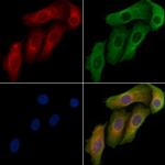 PNPase Antibody in Immunocytochemistry (ICC/IF)