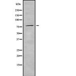 PNPase Antibody in Western Blot (WB)