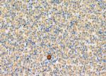 PPA1 Antibody in Immunohistochemistry (Paraffin) (IHC (P))