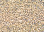 PPA1 Antibody in Immunohistochemistry (Paraffin) (IHC (P))