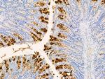 PF4 Antibody in Immunohistochemistry (Paraffin) (IHC (P))