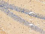 PPP1R2 Antibody in Immunohistochemistry (Paraffin) (IHC (P))