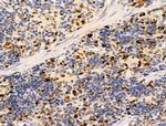 PPP1R2 Antibody in Immunohistochemistry (Paraffin) (IHC (P))