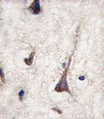 CD3g Antibody in Immunohistochemistry (Paraffin) (IHC (P))