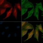 PSEN2 Antibody in Immunocytochemistry (ICC/IF)