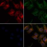 PSEN2 Antibody in Immunocytochemistry (ICC/IF)