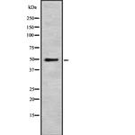 PSEN2 Antibody in Western Blot (WB)