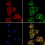 PRMT3 Antibody in Immunocytochemistry (ICC/IF)