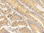 PRMT3 Antibody in Immunohistochemistry (Paraffin) (IHC (P))