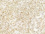 PRMT5 Antibody in Immunohistochemistry (Paraffin) (IHC (P))