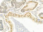 PRMT5 Antibody in Immunohistochemistry (Paraffin) (IHC (P))