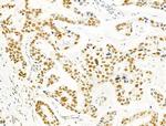 PRMT5 Antibody in Immunohistochemistry (Paraffin) (IHC (P))