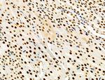 PRMT5 Antibody in Immunohistochemistry (Paraffin) (IHC (P))