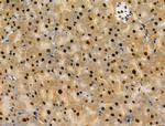 PRMT5 Antibody in Immunohistochemistry (Paraffin) (IHC (P))