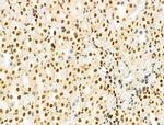 PRMT5 Antibody in Immunohistochemistry (Paraffin) (IHC (P))