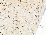 PRMT5 Antibody in Immunohistochemistry (Paraffin) (IHC (P))