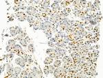 PRMT5 Antibody in Immunohistochemistry (Paraffin) (IHC (P))