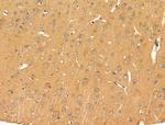 PRRG4 Antibody in Immunohistochemistry (Paraffin) (IHC (P))