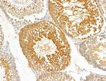 PRRG4 Antibody in Immunohistochemistry (Paraffin) (IHC (P))