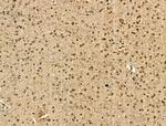 PU.1 Antibody in Immunohistochemistry (Paraffin) (IHC (P))