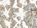 PU.1 Antibody in Immunohistochemistry (Paraffin) (IHC (P))