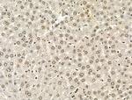 PU.1 Antibody in Immunohistochemistry (Paraffin) (IHC (P))