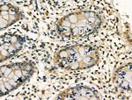 PU.1 Antibody in Immunohistochemistry (Paraffin) (IHC (P))