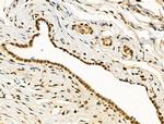 PU.1 Antibody in Immunohistochemistry (Paraffin) (IHC (P))