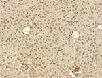 PU.1 Antibody in Immunohistochemistry (Paraffin) (IHC (P))