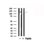 PYK2 Antibody in Western Blot (WB)