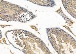 RAB11FIP1 Antibody in Immunohistochemistry (Paraffin) (IHC (P))