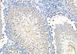 RAB11FIP1 Antibody in Immunohistochemistry (Paraffin) (IHC (P))