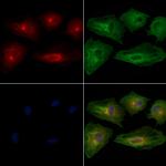 RAB17 Antibody in Immunocytochemistry (ICC/IF)