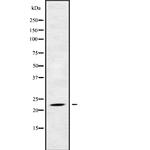 RAB17 Antibody in Western Blot (WB)