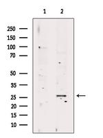 RAB23 Antibody in Western Blot (WB)