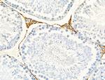 Renin Antibody in Immunohistochemistry (Paraffin) (IHC (P))