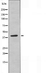 Renin Antibody in Western Blot (WB)