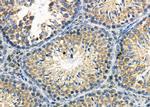 ATP6IP2 Antibody in Immunohistochemistry (Paraffin) (IHC (P))