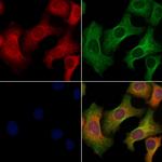 RET Antibody in Immunocytochemistry (ICC/IF)