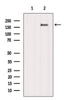 RET Antibody in Western Blot (WB)