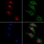 RB1 Antibody in Immunocytochemistry (ICC/IF)