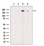 RICTOR Antibody in Western Blot (WB)