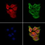 RPE65 Antibody in Immunocytochemistry (ICC/IF)