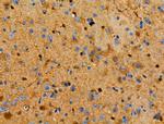 S100 Antibody in Immunohistochemistry (Paraffin) (IHC (P))