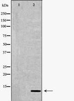 S100 Antibody in Western Blot (WB)